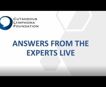 July 2020 - Answers from the Experts