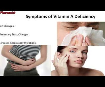 Symptoms of Vitamin A Deficiency