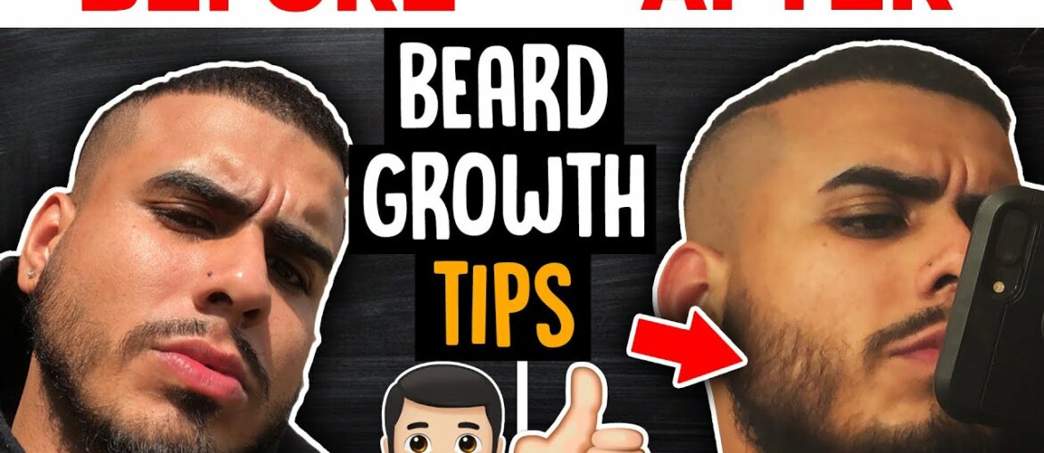 GROW A FULL BEARD FAST DOING THESE THREE THINGS | BEARD GROWTH TIPS