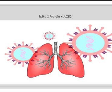 COVID-19 and Kidney Diseases