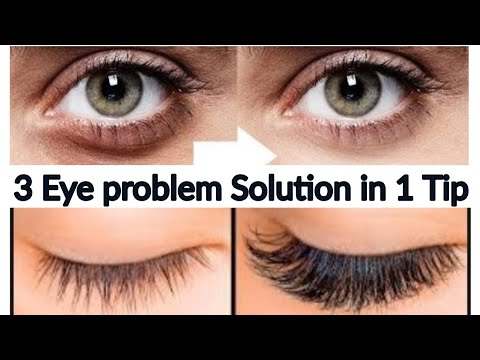 Dark Circles, Wrinkles & Eye lashes growth Solution In 1 Video | Real Beauty Secrets In Urdu & Hindi