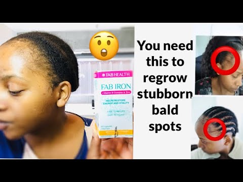 Fab iron + Vitamin B Complex & Zin review ( fab iron tablets regrow) hair vitamins for hair loss