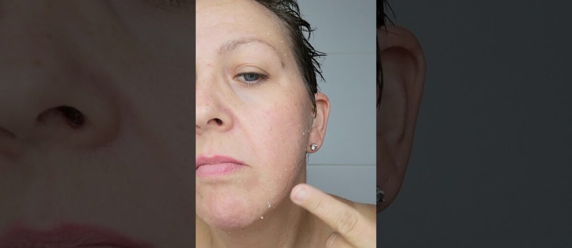 Vitamin c liquid peel