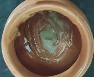 DIY to remove dark circles in 7 days with  Vitamin - E capsule