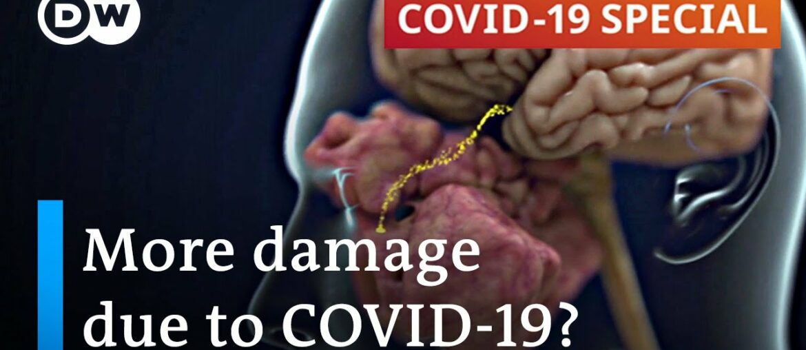 More long-term damage caused by COVID-19 than expected | COVID-19 Special