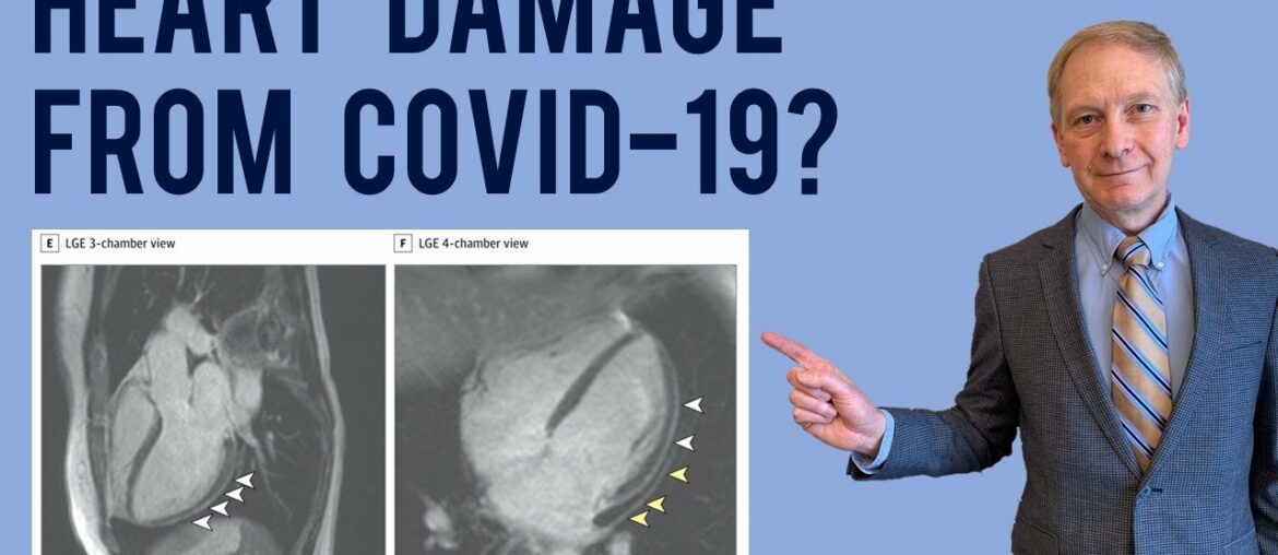 Coronavirus heart disease, will there be long-term effects?