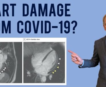 Coronavirus heart disease, will there be long-term effects?