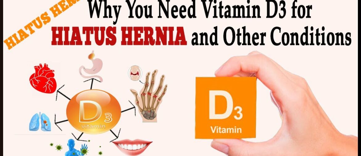 Hiatus Hernia: Why You Need Vitamin D3 for Hiatus Hernia or Other Conditions