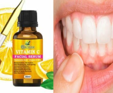 Vitamin C: Why we need it and  dietary sources | In HINDI | LIFE CHANGER SHIVAM |