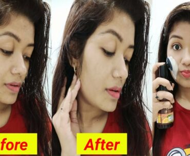 15 Days Challenge With VITAMIN C | For Clear &  Even Tone Skin || Krrish Sarkar