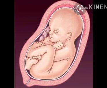 (part2) immunity and covid 19