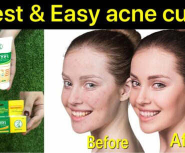 Complete acne and pimples treatment with the best beauty products