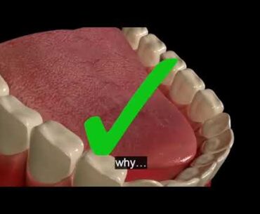 Best Supplement To Boost Dental Health