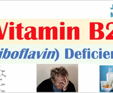 Vitamin B2 (Riboflavin) Deficiency | Food Sources, Causes, Symptoms, Diagnosis and Treatment