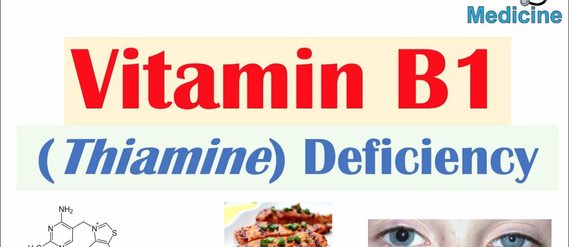 Vitamin B1 (Thiamine) Deficiency: Food Sources, Purposes, Absorption, Causes, Symptoms (ex Beriberi)