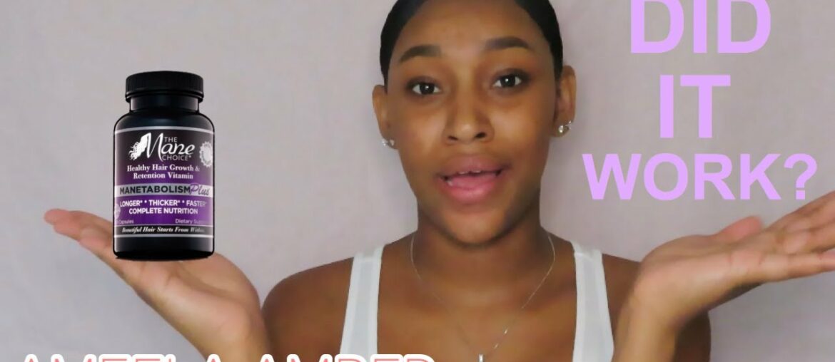 MANE CHOICE HAIR VITAMINS UPDATE|| WHY I STOPPED TAKING THEM