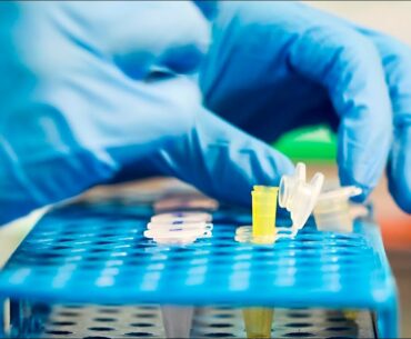 Scientists re-purposing antibody therapies to treat COVID-19