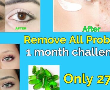 5 Magical beauty hacks using vitamin E- pimple, dark spots, pink lips, dark circles(NO TOOTHPASTE)