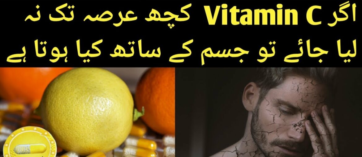Vitamin C deficiency 15 signs | Vitamin  C Ki Kami Ki 15 Nishania Urdu/Hindi