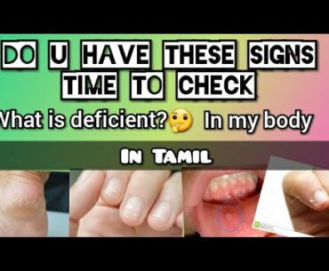 Signs that your body lacks vitamins | signs your body needs help | in Tamil | Miscellano
