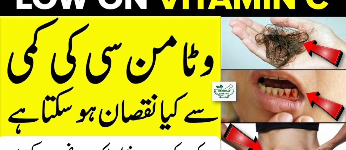 How Does Vitamin C Help Your Body In Hindi Urdu | Signs You Are Lacking Vitamin C | Vitamin C