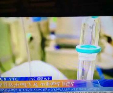 Lack of vitamin will more expose for corona virus