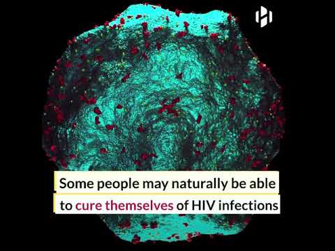 HIV patient recovers fully without drugs thanks to his rare immune response | HIV Infection