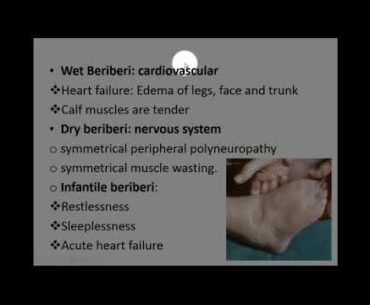 Nutrition,water soluble vitamins 5