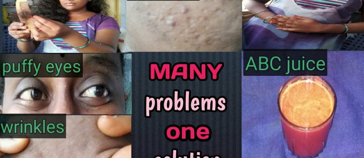 Skin whitening drink in telugu | skin whitening home remedies | beauty tips in tips in Telugu