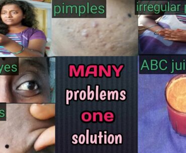 Skin whitening drink in telugu | skin whitening home remedies | beauty tips in tips in Telugu