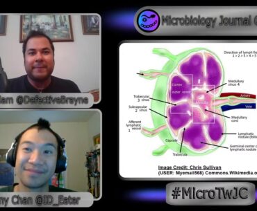 The messed up development of B-Cell Immunity in Severe COVID-19 Patients