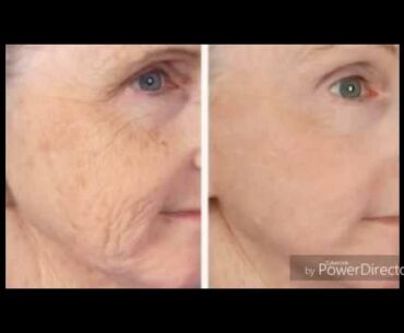 The amazing Benefits of Vitamin C Serum for your face.