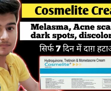 cosmelite cream | cosmelite cream review | cosmelite cream review hindi | cosmelite next cream |