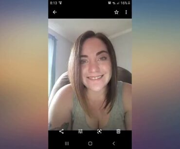 Acnetame- Vitamin Supplements for Acne Treatment, 60 Natural Pills review