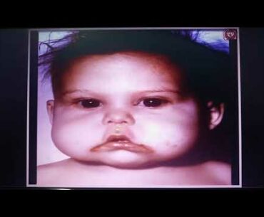 CLASS 11--NUTRITION  --VITAMIN  B6 & B9