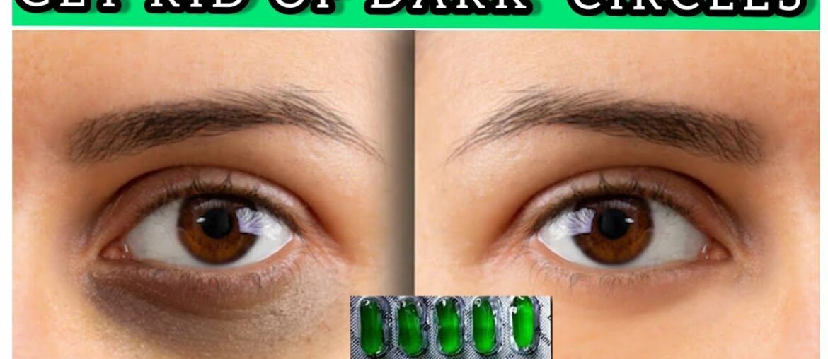 GET RID IF DARKCIRCLE  WITH VITAMIN  E OIL 8 September 2020