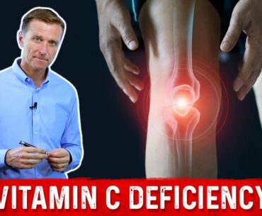 Could Your Joint Pain Be a Vitamin C Deficiency?
