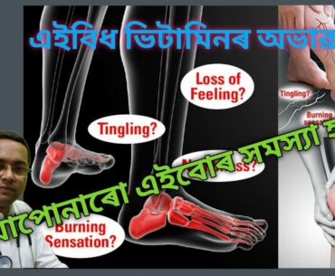 Vitamin B Complex And It’s Function | Vitamin B Complex Deficiency And It’s Symptoms And Causes