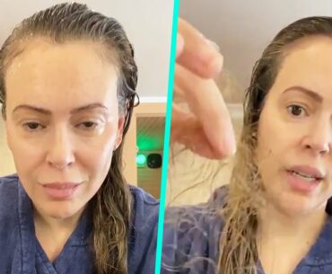 Alyssa Milano Reveals Shocking Hair Loss From COVID-19