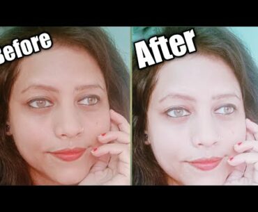 brightening and anti aging vitamin c serum under "10rs" only / homemade vitamins c serum