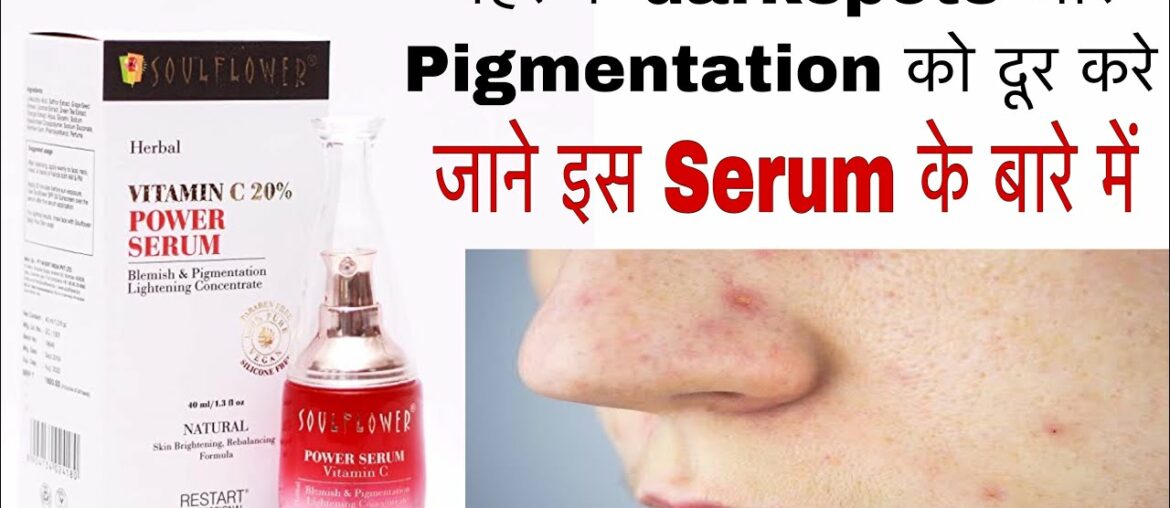 Soulflower Herbal Vitamin C Power Serum ki Jankari | Remove DarkSpots and Pigmentation From Face