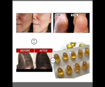 Top 8 uses of vitamin-e capsule for skin and hair || how to use vitamine-e capsule for skin