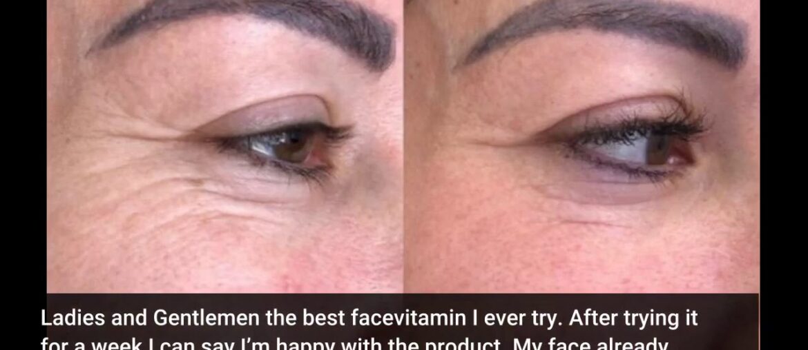 Review Vitamin C Serum for Face with Hyaluronic Acid, Vitamin E & Niacinamide (B3) Face Serum f...