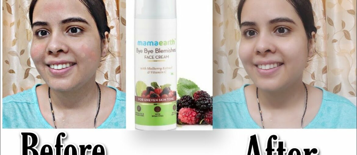 Bye Bye blemishes face cream with Mulberry extract & vitamin c review | face cream