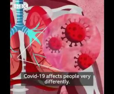 How covid19 will affect human immune system