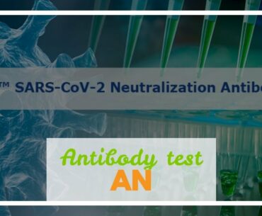 Antibody test developed for COVID-19 that is sensitive, specific and scalable