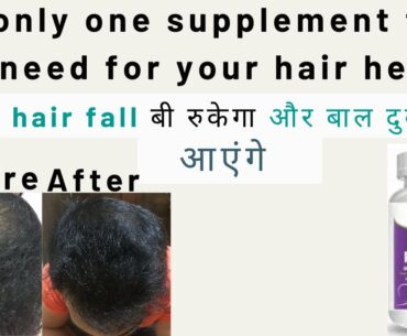 The only one supplement that you need for your hair health | how to stop hair fall | hair loss