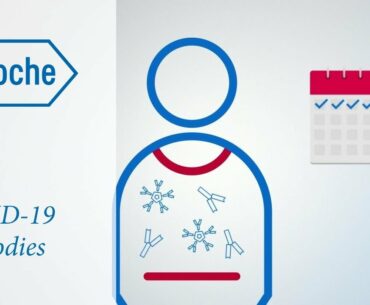 Roche Covid19 antibody