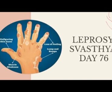 Leprosy I Day- 76