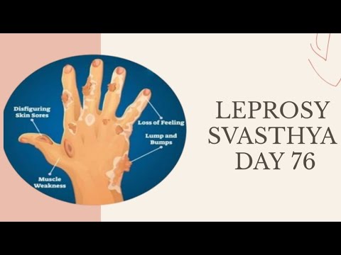 Leprosy I Day- 76